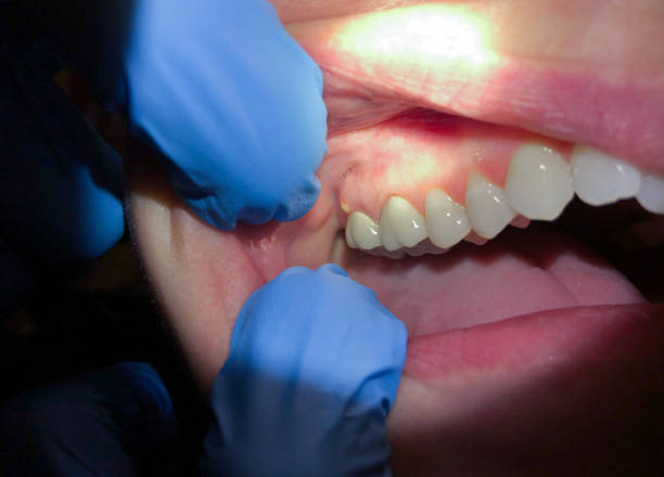 Best Emergency Dental Care for Trauma or Injury in Palatine, IL